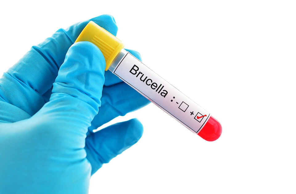 Brusella Nedir? Brusella Hastalığı ve Brusella Tedavisi