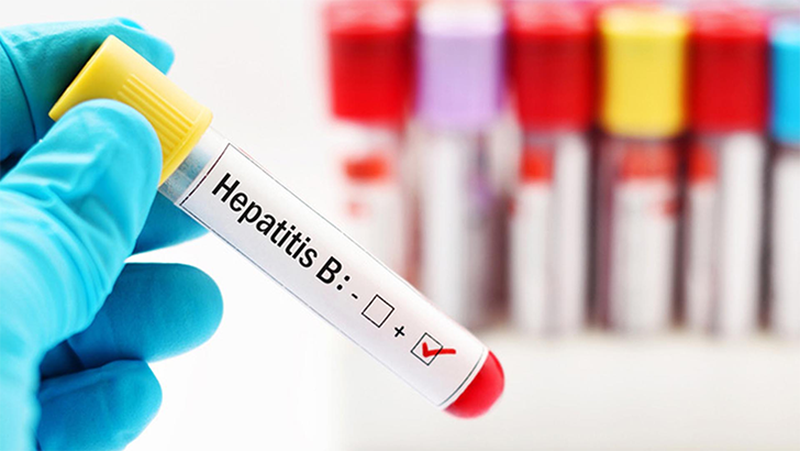 Hepatit Nedir? Hepatit A ve Hepatit B