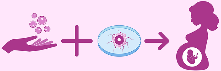 Yumurta Donasyonu Nedir? Sperm Donasyonu Nedir?